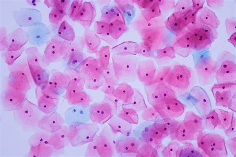 celulas epiteliais raras - celulas do sangue